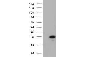 Western Blotting (WB) image for anti-MOB Kinase Activator 3B (MOB3B) antibody (ABIN1499537) (MOBKL2B anticorps)