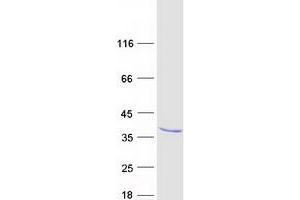 Validation with Western Blot