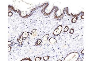 anti-Keratin 17 (KRT17) antibody
