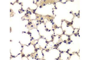 Immunohistochemistry of paraffin-embedded Mouse lung using CXXC1 Polyclonal Antibody at dilution of 1:200 (40x lens). (CXXC1 anticorps)