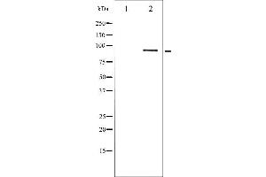 Western blot analysis of STAT5B phosphorylation expression in RAW264.