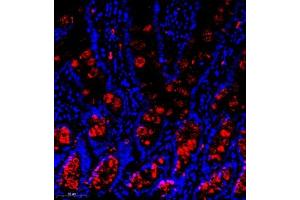Immunofluorescence of paraffin embedded rat small intestine using Znt1 (ABIN7075672) at dilution of 1:650 (300x lens)