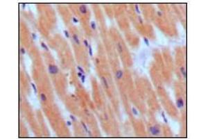 Immunohistochemical analysis of paraffin-embedded human normal myocardium, showing cytoplasmic localization using BNP3 mouse mAb with DAB staining. (BNP anticorps)