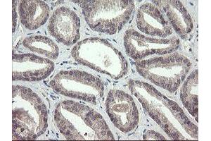 anti-F-Box Protein 42 (FBXO42) (AA 356-717) antibody