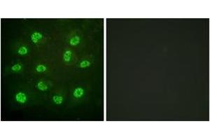 Immunofluorescence analysis of HuvEc cells, using Estrogen Receptor-beta (Phospho-Ser105) Antibody. (ESR2 anticorps  (pSer105))