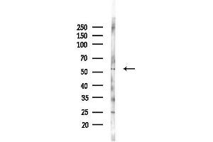 anti-Transcription Factor Dp-1 (TFDP1) (C-Term) antibody
