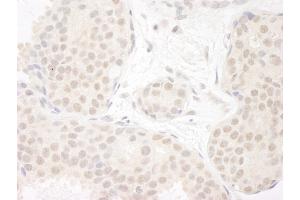 anti-DEAD (Asp-Glu-Ala-Asp) Box Polypeptide 23 (DDX23) (AA 1-50) antibody