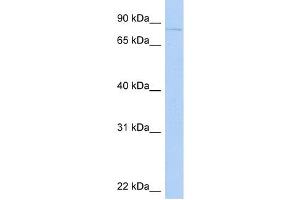 KIF2C antibody used at 1 ug/ml to detect target protein. (KIF2C anticorps  (N-Term))