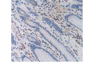 IHC-P analysis of Human Stomach Tissue, with DAB staining. (PZP anticorps  (AA 1212-1391))