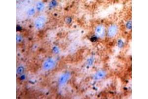 Used in DAB staining on fromalin fixed paraffin-embedded brain tissue (S100 Protein (S100) (AA 1-94) anticorps)