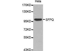 Western Blotting (WB) image for anti-Splicing Factor Proline/glutamine-Ric (SFPQ) (AA 578-707) antibody (ABIN1513519) (SFPQ anticorps  (AA 578-707))
