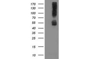 Image no. 2 for anti-Sequestosome 1 (SQSTM1) antibody (ABIN1499987) (SQSTM1 anticorps)