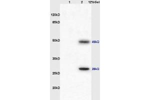 Lane 1: mouse spleen lysates Lane 2: mouse heart lysates probed with Anti IgJ Polyclonal Antibody, Unconjugated  at 1:3000 90min in 37˚C.