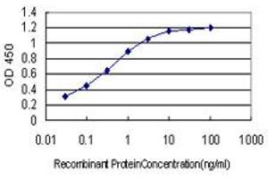 Detection limit for recombinant GST tagged ARID1B is approximately 0. (ARID1B anticorps  (AA 1364-1460))
