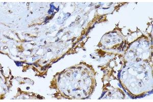 Immunohistochemistry of paraffin-embedded Human placenta using RPS27A Polyclonal Antibody at dilution of 1:100 (40x lens).