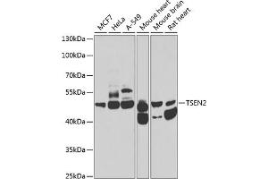 Western blot analysis of extracts of various cell lines, using TSEN2 antibody (ABIN6131375, ABIN6149615, ABIN6149616 and ABIN6223809) at 1:1000 dilution. (TSEN2 anticorps  (AA 1-220))