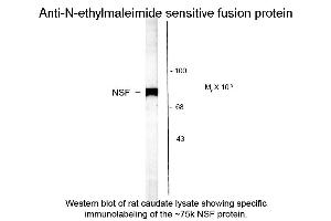 Western blot of Anti-NSF (N-ethylmaleimide sensitive fusion protein) (Rabbit) Antibody - 612-401-E01 Western Blot of Rabbit anti-NSF (N-ethylmaleimide sensitive fusion protein) antibody. (NSF anticorps  (C-Term))