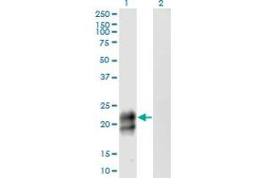 Western Blot analysis of TNFRSF17 expression in transfected 293T cell line by TNFRSF17 monoclonal antibody (M06), clone 3H6.