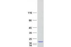 Validation with Western Blot