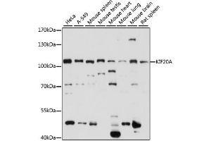 Western blot analysis of extracts of various cell lines, using KIF20A antibody (ABIN7268125) at 1:1000 dilution.