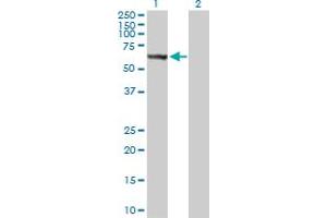 Western Blot analysis of STK33 expression in transfected 293T cell line by STK33 MaxPab polyclonal antibody. (STK33 anticorps  (AA 1-514))