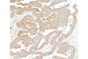 Immunohistochemistry (IHC) image for anti-Mitochondrial Calcium Uniporter (MCU) (AA 300-350) antibody (ABIN7795789)