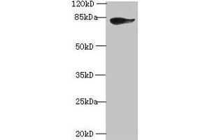 Western blot All lanes: JUP antibody at 2 μg/mL + A431 whole cell lysate Secondary Goat polyclonal to rabbit IgG at 1/10000 dilution Predicted band size: 82 kDa Observed band size: 82 kDa (JUP anticorps  (AA 1-131))