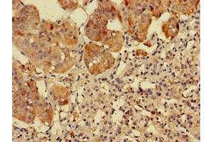Immunohistochemistry of paraffin-embedded human adrenal gland tissue using ABIN7142563 at dilution of 1:100