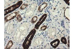 Image no. 1 for anti-Tripartite Motif Containing 45 (TRIM45) (AA 288-580) antibody (ABIN1491333)