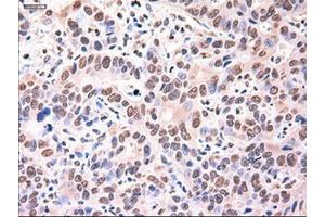 Immunohistochemistry (IHC) image for anti-alpha-Fetoprotein (AFP) (AA 19-397) antibody (ABIN2716010)