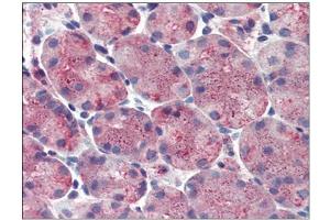 Stomach: Formalin-Fixed, Paraffin-Embedded (FFPE) (ERP44 anticorps  (Internal Region))