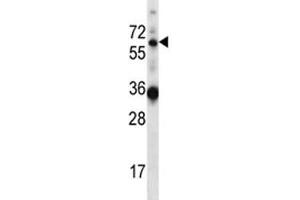 GATAD2B antibody western blot analysis in mouse heart tissue lysate
