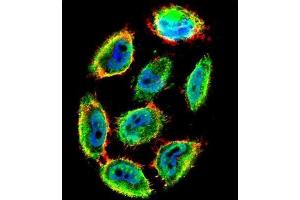 Immunofluorescence (IF) image for anti-Tumor Protein P53 (TP53) (pSer9) antibody (ABIN3001774)