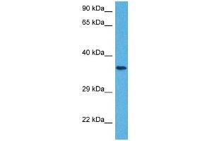 Host:  Rabbit  Target Name:  SLC25A32  Sample Tissue:  Human Jurkat Whole Cell  Antibody Dilution:  1ug/ml (SLC25A32 anticorps  (N-Term))