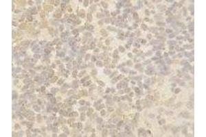 Image no. 1 for anti-Cullin 4B (CUL4B) antibody (ABIN1502456)