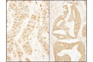 anti-Basic Transcription Factor 3 (BTF3) (AA 35-70) antibody