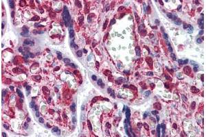 Human Placenta: Formalin-Fixed, Paraffin-Embedded (FFPE)