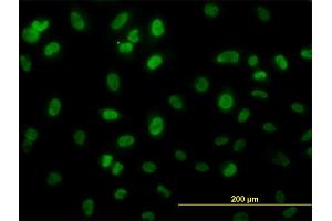Immunofluorescence of monoclonal antibody to HSGT1 on HeLa cell.