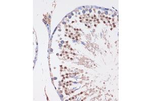Immunohistochemistry of paraffin-embedded Rat testis using LYAR Rabbit pAb  at dilution of 1:100 (40x lens).