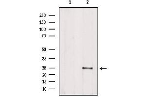 Western blot analysis of extracts from Hela, using PIGF Antibody. (PIGF anticorps  (Internal Region))