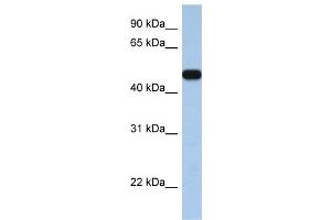 WB Suggested Anti-SLC25A46  Antibody Titration: 0. (SLC25A46 anticorps  (C-Term))