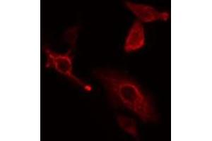 ABIN6277589 staining HeLa cells by IF/ICC. (CBR1 anticorps  (C-Term))