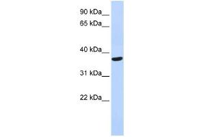 WB Suggested Anti-SPDYA Antibody Titration: 0. (SPDYA anticorps  (Middle Region))