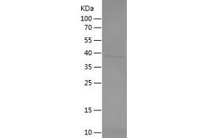 Western Blotting (WB) image for Thrombopoietin (THPO) (AA 22-195) protein (His-IF2DI Tag) (ABIN7125375)