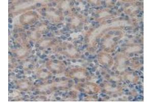 IHC-P analysis of Rat Kidney Tissue, with DAB staining. (GATA4 anticorps  (AA 228-440))