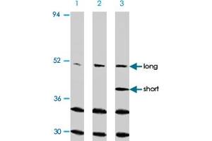 Western blot analysis of CASP2 in Ramos cells with CASP2 polyclonal antibody at (A) 0. (Caspase 2 anticorps  (N-Term))