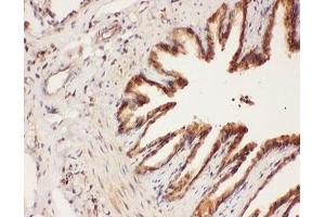 IHC-P: ALOX15 antibody testing of rat lung tissue (ALOX15 anticorps  (AA 2-337))