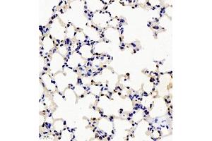 Immunohistochemistry of paraffin embedded mouse lung using rap1 (ABIN7075857) at dilution of 1: 3000 (400x lens)