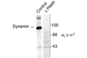 Image no. 1 for anti-Dynamin 1 (DNM1) (pSer774) antibody (ABIN372616) (Dynamin 1 anticorps  (pSer774))