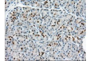 Immunohistochemistry (IHC) image for anti-3-hydroxybutyrate Dehydrogenase, Type 2 (BDH2) antibody (ABIN1496856)